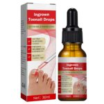 Ingrown-Toenail-Pain-Relief Professional ONLY $7.18! Thumbnail